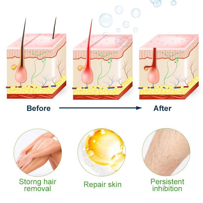 Semi-Permanent Hair Removal Spray